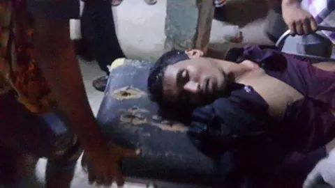 جرحى برصاص الأمن اليمني وحالات اختناق بالمعلاء الآن (مصور )