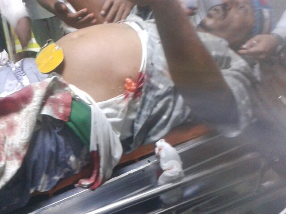 أصابة قيادي بالثورة الجنوبية بالمحفد في أحداث المعلاء