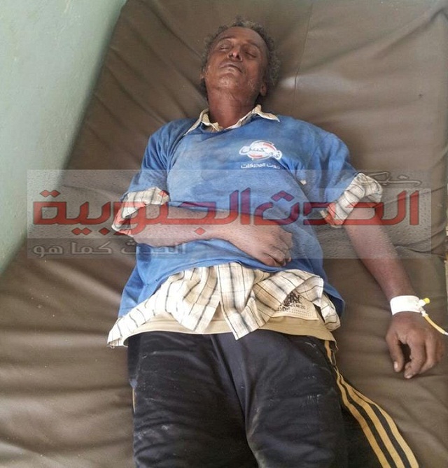  جنود الجيش اليمني  يعتدون على مختل عقلياً بالمحفد