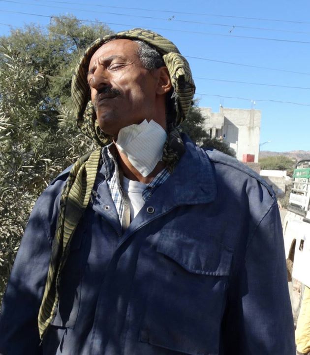 الضالع – سقوط جريح بقصف الجيش اليمني وعصيان مدني شامل بكافة المديريات