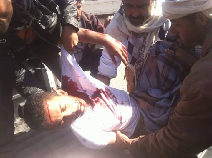 سقوط شهيد باشتباكات مع مسلحين يستقلون طقم عسكري بالضالع