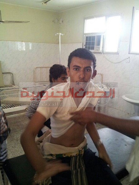  إصابة مواطن بالمحفد برصاص الجيش اليمني