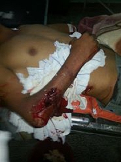 إصابة شاب برصاص الجيش اليمني بالضالع (مصور)