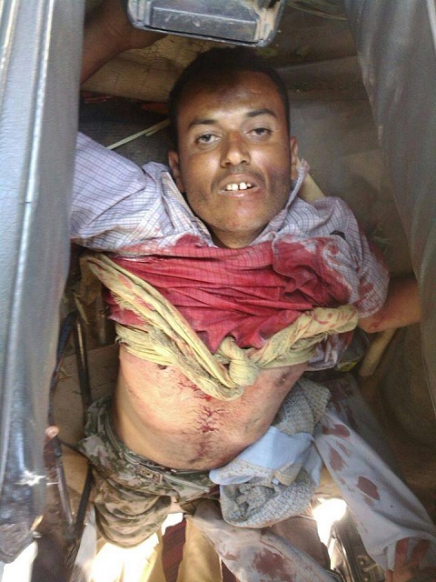 سقوط شهيد من أبناء الضالع الآن في منطقة سناح الحدودية برصاص الجيش اليمني