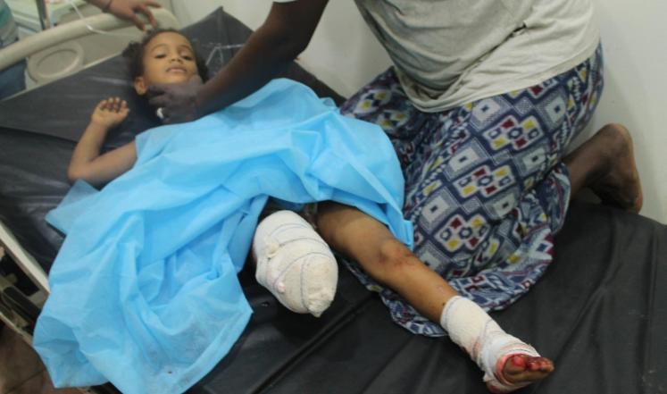 ووتش: انتهاكات الحوثيين قد ترقى لجرائم حرب