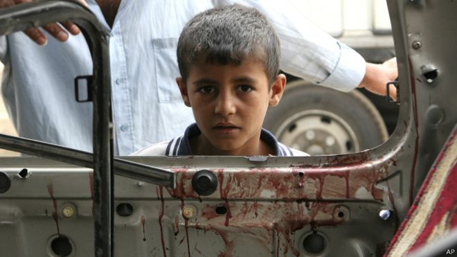 بعد صناعة الحرب 15 بند تصنع السلام في اليمن