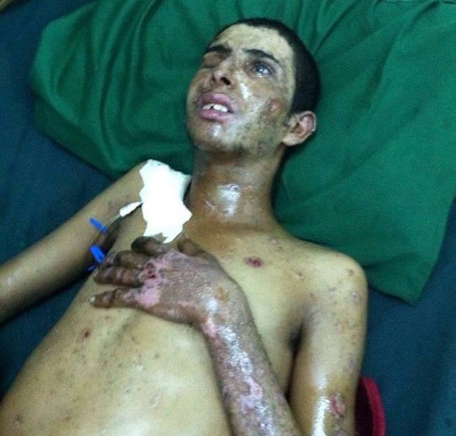 إلى حكومة الشرعية : أنقذوا الجريح عمار فضل قاسم الضالعي