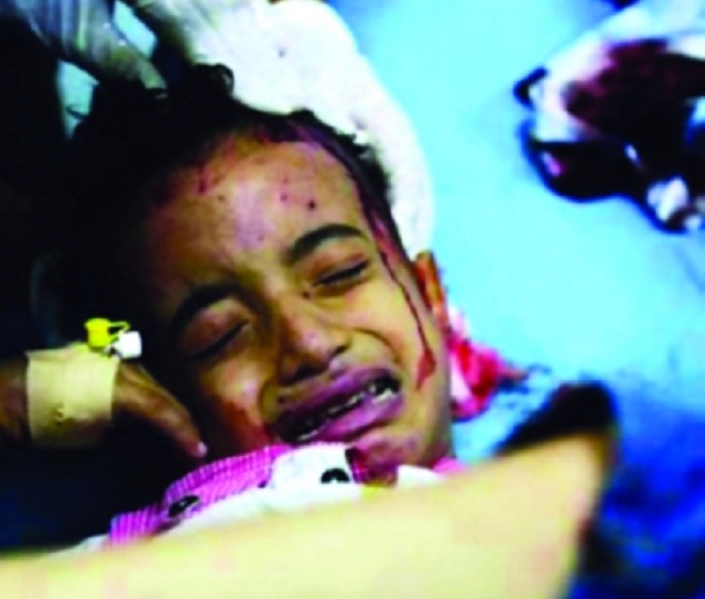 «لا تقبروناش» صرخة طفل مزّقه الموت الحوثي