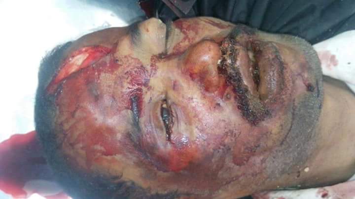 استشهاد مقاوم جنوبي في عدن برصاص مجهولين