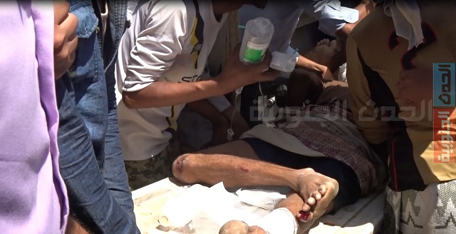 جرحى من المقاومة الجنوبية بقصف خاطئ لطيران التحالف بعقبة ثرة (صور)