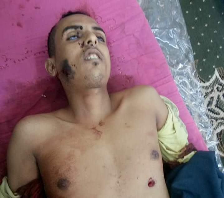 استشهاد شاب برصاص بلاطجة بكريتر وقبائل الشعيب تتداعى للرد