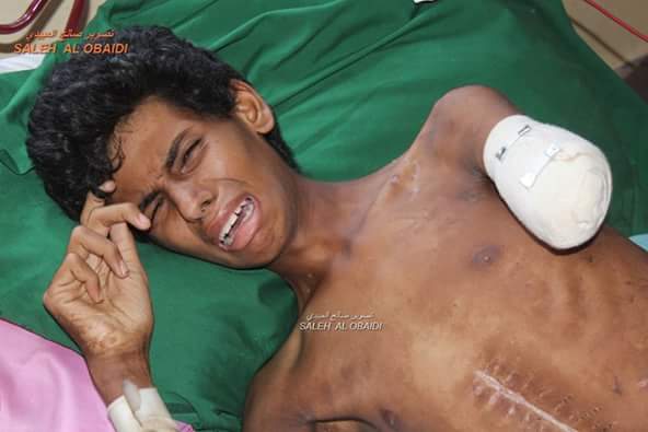 الطفل الجريح يافخامة الرئيس !