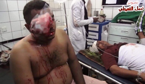 نادي عدن للتصوير يعرض غدًا فيلم “حرب عدن في ذاكرة المصورين” يعقبه تكريمهم